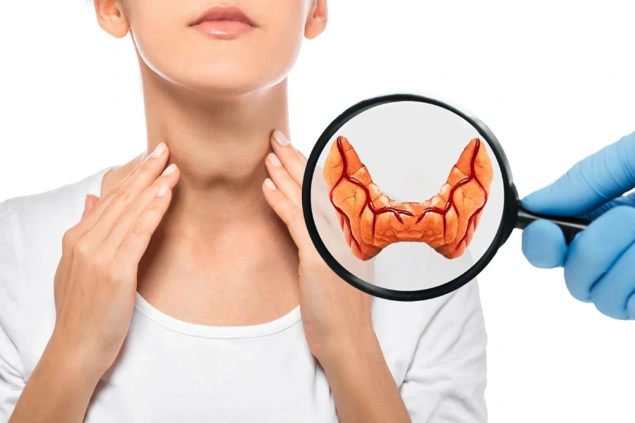 علائم تیروئید کم کار + برای کم کاری تیروئید چه بخوریم 30 علائم تیروئید کم کار + برای کم کاری تیروئید چه بخوریم