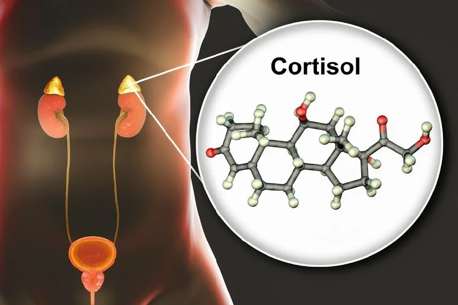 علائم بالا بودن سطح کورتیزول در بدن چیست؟